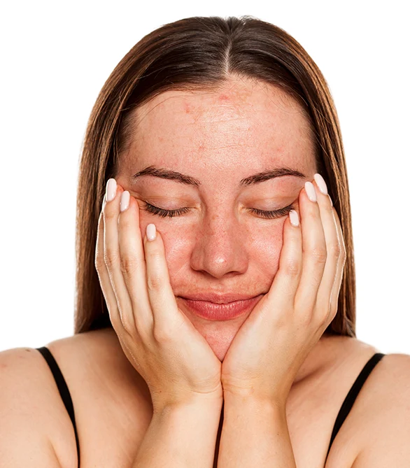 liver spots treatment at Ivy Aesthetics & Laser Spa in Memphis, Tennessee.